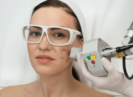 Rajeunissement du laser sur le terrain
