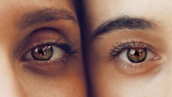 Cercles sombres sous les yeux
