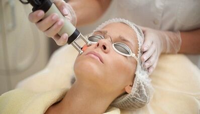 types de rajeunissement fractionné de la peau du visage